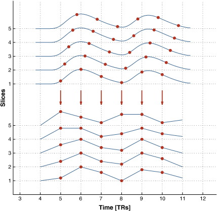 slice timing problem